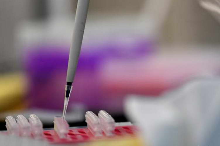 САД одобри тест за коронавирус кој чини пет долари